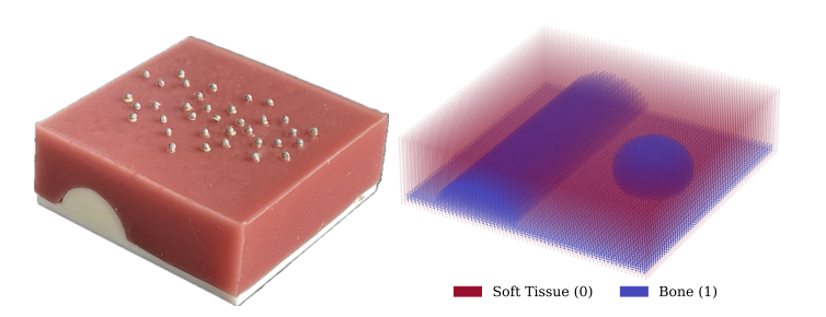 Soft and hard tissue simulation
